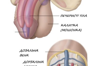 Що таке рак статевого члена?